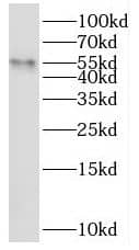 Western Blot SHE Antibody - BSA Free