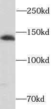 Western Blot: SH3PXD2A Antibody - BSA Free [NBP3-45362] - HeLa cells were subjected to SDS PAGE followed by western blot with (SH3PXD2A antibody) at dilution of 1:500