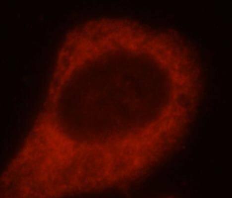 Immunocytochemistry/ Immunofluorescence: SH3PXD2A Antibody - BSA Free [NBP3-45362] - Immunofluorescent analysis of HepG2 cells using  (SH3PXD2A antibody) at dilution of 1:25 and Rhodamine-Goat anti-Rabbit IgG