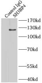 Immunoprecipitation: SH3BP4 Antibody - BSA Free [NBP3-45364] - IP Result of anti-SH3BP4 (IP:, 4ug; Detection: 1:300) with mouse lung tissue lysate 3600ug.
