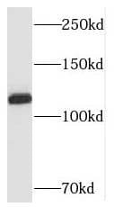 Western Blot SH3BP4 Antibody - BSA Free