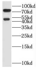 Western Blot: SH3BP1 Antibody - BSA Free [NBP3-45365] - Mouse lung tissue were subjected to SDS PAGE followed by western blot with (SH3BP1 antibody) at dilution of 1:500