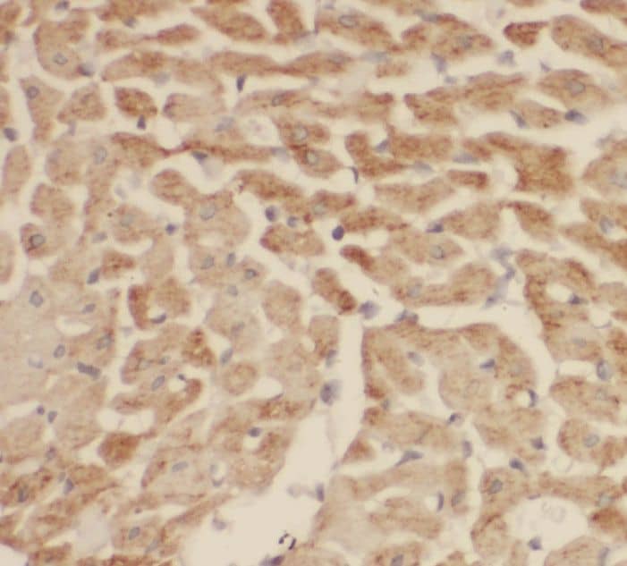 Immunohistochemistry: SH3BGR Antibody - BSA Free [NBP3-45366] - Immunohistochemistry of paraffin-embedded human heart tissue slide using (SH3BGR Antibody) at dilution of 1:50
