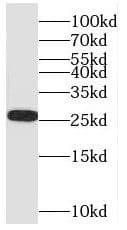 Western Blot SH3BGR Antibody - BSA Free