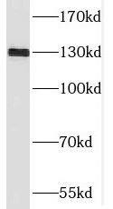 Western Blot: SGSM1 Antibody - BSA Free [NBP3-45369] - Mouse testis tissue were subjected to SDS PAGE followed by western blot with (SGSM1 antibody) at dilution of 1:500