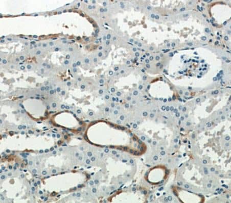 Immunohistochemistry SGLT3/SLC5A4 Antibody - BSA Free