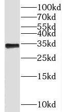 Western Blot: CCDC101 Antibody - BSA Free [NBP3-45371] - HeLa cells were subjected to SDS PAGE followed by western blot with (CCDC101 antibody) at dilution of 1:1000