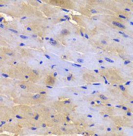 Immunohistochemistry: epsilon-Sarcoglycan Antibody - BSA Free [NBP3-45374] - Immunohistochemistry of paraffin-embedded mouse heart using ( epsilon-Sarcoglycan Antibody) at dilution of 1:100