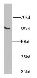 Western Blot epsilon-Sarcoglycan Antibody - BSA Free