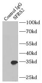 Immunoprecipitation: SC35 Antibody - BSA Free [NBP3-45378] - IP Result of anti-SC35 (IP:, 4ug; Detection: 1:300) with mouse brain tissue lysate 4000ug.
