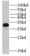 Western Blot: SC35 Antibody - BSA Free [NBP3-45378] - Mouse brain tissue were subjected to SDS PAGE followed by western blot with (SC35 antibody) at dilution of 1:300