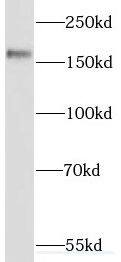 Western Blot: SETBP1 Antibody - BSA Free [NBP3-45386] - HeLa cells were subjected to SDS PAGE followed by western blot with FNab07768( SETBP1 Antibody) at dilution of 1:300