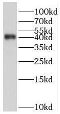 Western Blot: SerpinB9 Antibody - BSA Free [NBP3-45387] - K-562 cells were subjected to SDS PAGE followed by western blot with (SerpinB9 antibody) at dilution of 1:2000