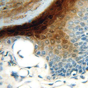 Immunohistochemistry: SERPINB13 Antibody - BSA Free [NBP3-45388] - Immunohistochemistry of paraffin-embedded human skin tissue slide using (SERPINB13 antibody) at dilution of 1:100