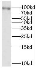 Western Blot: SERCA3 ATPase Antibody - BSA Free [NBP3-45393] - Mouse skeletal muscle tissue were subjected to SDS PAGE followed by western blot with (SERCA3 ATPase antibody) at dilution of 1:500