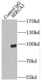 Immunoprecipitation: SERCA3 ATPase Antibody - BSA Free [NBP3-45393] - IP Result of anti-SERCA3 (IP:, 4ug; Detection: 1:500) with mouse skeletal muscle tissue lysate 3600ug.