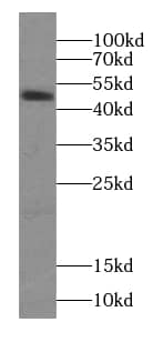 Western Blot: Septin-6 Antibody - BSA Free [NBP3-45396] - Jurkat cells were subjected to SDS PAGE followed by western blot with (SEPT6 Antibody) at dilution of 1:600