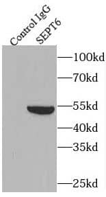 Immunoprecipitation: Septin-6 Antibody - BSA Free [NBP3-45396] - IP Result of anti-SEPT6 (IP:, 4ug; Detection: 1:600) with rat brain tissue lysate 4000ug.