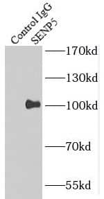 Immunoprecipitation: SENP5 Antibody - BSA Free [NBP3-45399] - IP Result of anti-SENP5 (IP:, 4ug; Detection: 1:300) with HeLa cells lysate 520ug.