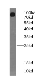 Western Blot: SENP5 Antibody - BSA Free [NBP3-45399] - HeLa cells were subjected to SDS PAGE followed by western blot with (SENP5 antibody) at dilution of 1:300