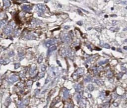 Immunohistochemistry: SEC61B Antibody - BSA Free [NBP3-45409] - Immunohistochemistry of paraffin-embedded human cervical cancer tissue slide using (SEC61B Antibody) at dilution of 1:50