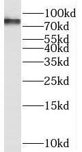 Western Blot: SEC14L1 Antibody - BSA Free [NBP3-45413] - Y79 cells were subjected to SDS PAGE followed by western blot with ( SEC14L1 Antibody) at dilution of 1:300