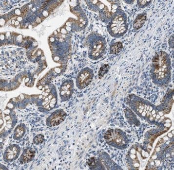 Immunohistochemistry: HSPC105 Antibody - BSA Free [NBP3-45415] - Immunohistochemistry of paraffin-embedded human intestine using (HSPC105 antibody) at dilution of 1:50