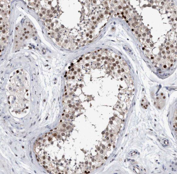 Immunohistochemistry SDF2L1 Antibody - BSA Free