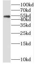 Western Blot: SDCCAG3 Antibody - BSA Free [NBP3-45418] - Mouse pancreas tissue were subjected to SDS PAGE followed by western blot with (SDCCAG3 Antibody) at dilution of 1:300