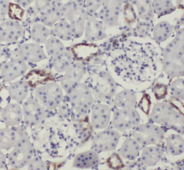 Immunohistochemistry SCUBE3 Antibody - BSA Free
