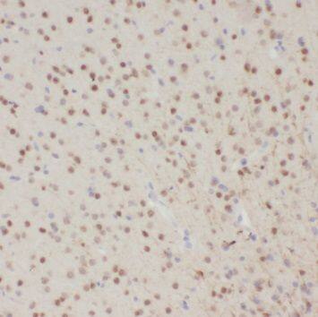 Immunohistochemistry SCNM1 Antibody - BSA Free