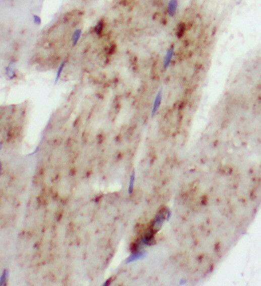Immunohistochemistry: SCN4B Antibody - BSA Free [NBP3-45427] - Immunohistochemistry of paraffin-embedded human skeletal muscle tissue slide using (SCN4B Antibody) at dilution of 1:50