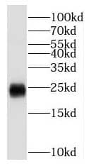 Western Blot Scn2b Antibody - BSA Free