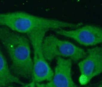 Immunocytochemistry/ Immunofluorescence: Nav1.8 Antibody - BSA Free [NBP3-45429] - Immunofluorescent analysis of SH-SY5Y cells, using SCN10A antibody  at 1:25 dilution.