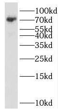Western Blot SCML2 Antibody - BSA Free
