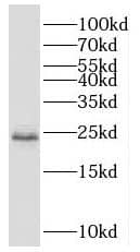 Western Blot: SCML1 Antibody - BSA Free [NBP3-45432] - HepG2 cells were subjected to SDS PAGE followed by western blot with (SCML1 antibody) at dilution of 1:400