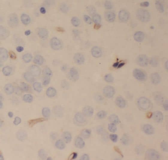 Immunohistochemistry: SCHIP1 Antibody - BSA Free [NBP3-45434] - Immunohistochemistry of paraffin-embedded mouse brain tissue slide using (SCHIP1 Antibody) at dilution of 1:50