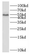 Western Blot: SCHIP1 Antibody - BSA Free [NBP3-45434] - HeLa cells were subjected to SDS PAGE followed by western blot with (SCHIP1 Antibody) at dilution of 1:600