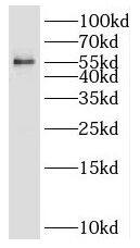 Western Blot: SC65 Antibody - BSA Free [NBP3-45441] - Human bladder tissue were subjected to SDS PAGE followed by western blot with (SC65 antibody) at dilution of 1:400