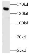 Western Blot SBNO1 Antibody - BSA Free