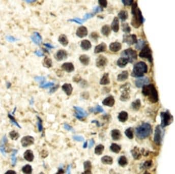 Immunohistochemistry SBNO1 Antibody - BSA Free