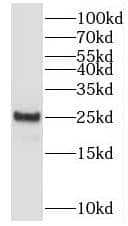 Western Blot: SAR1B Antibody - BSA Free [NBP3-45445] - Mouse liver tissue were subjected to SDS PAGE followed by western blot with (SAR1B antibody) at dilution of 1:500