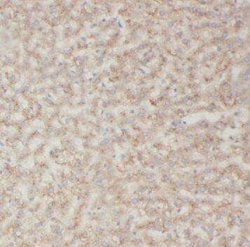 Immunohistochemistry: SAR1B Antibody - BSA Free [NBP3-45445] - Immunohistochemistry of paraffin-embedded human liver using (SAR1B antibody) at dilution of 1:100