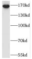 Western Blot: SAMD9L Antibody - BSA Free [NBP3-45448] - COLO 320 cells were subjected to SDS PAGE followed by western blot with (SAMD9L Antibody) at dilution of 1:1000