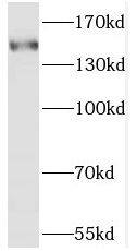 Western Blot: SAMD9 Antibody - BSA Free [NBP3-45449] - HeLa cells were subjected to SDS PAGE followed by western blot with (SAMD9 antibody) at dilution of 1:1000