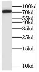 Western Blot: SAMD4B Antibody - BSA Free [NBP3-45450] - HeLa cells were subjected to SDS PAGE followed by western blot with (SAMD4B antibody) at dilution of 1:800