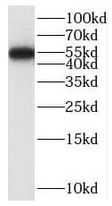 Western Blot: SAMD14 Antibody - BSA Free [NBP3-45452] - COLO 320 cells were subjected to SDS PAGE followed by western blot with (SAMD14 Antibody) at dilution of 1:600