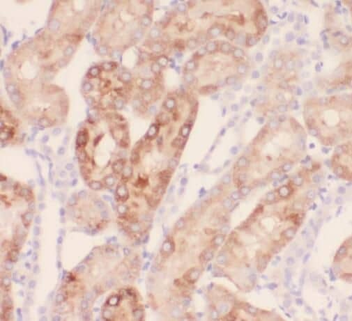 Immunohistochemistry: SAMD14 Antibody - BSA Free [NBP3-45452] - Immunohistochemistry of paraffin-embedded human kidney tissue slide using (SAMD14 Antibody) at dilution of 1:50