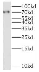 Western Blot SAMD11 Antibody - BSA Free