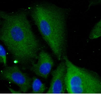 Immunocytochemistry/ Immunofluorescence SAA2 Antibody - BSA Free